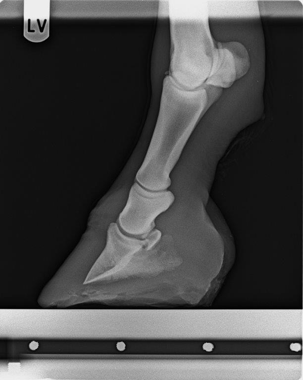 Röntgenbild seitlich v.l. 17.11.14.jpg