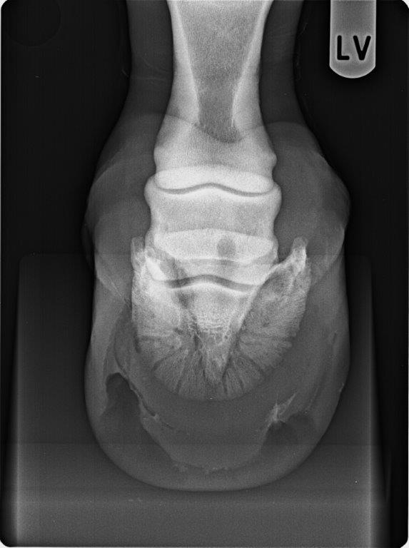 Röntgenbild von vorne v.l. 17.11.14.jpg