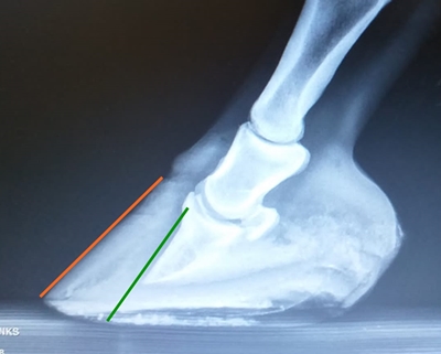 Hier nocheinmal zur Verdeutlichung das gleiche Bild mit eingezeichneten Linien. Bei einem gesunden Huf verlaufen diese parallel zueinander.